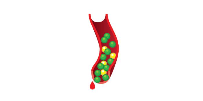 3. Diabetes tipo 2: el cuerpo se vuelve resistente a la insulina, lo que provoca niveles altos de azúcar en la sangre y aumenta el riesgo de diabetes tipo 2.